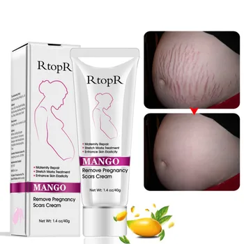 RtopR Mango Stretch Mark Cream Přírodní Mírné, Non-dráždivý Pro Odstranění Těhotenství, Jizvy po Akné Krém Repair Anti-Aging Anti Winkles