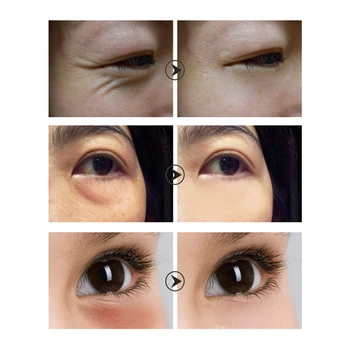 LANBENA Vitamin C Bělení Oční Krém Odstraňuje Tmavé Kruhy, Oční Tašky Anti-Aging Oční Sérum Anti-Oxidant Zpevnění Opuchlé Péče o Pleť