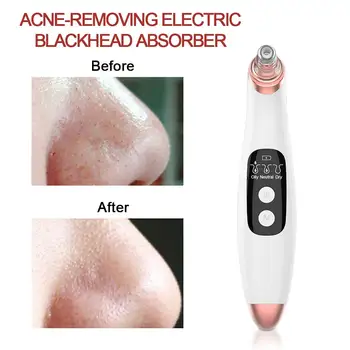 Elektrické Pupínek Remover Obličeje Čistící Stroj Vakuové Pórů, Akné Sací Černá Tečka Pupínek Remover Skin Scrubber Beauty Stroj