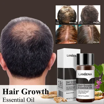 LANBENA Růst Vlasů Podstatě Rychlé Výkonné Produkty pro Péči o Vlasy Tekuté Léčba Sérum Andrea Proti vypadávání Vlasů Esenciální Olej 20 ml