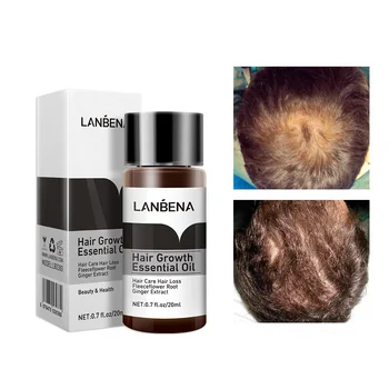 LANBENA Růst Vlasů Podstatě Rychlé Výkonné Produkty pro Péči o Vlasy Tekuté Léčba Sérum Andrea Proti vypadávání Vlasů Esenciální Olej 20 ml