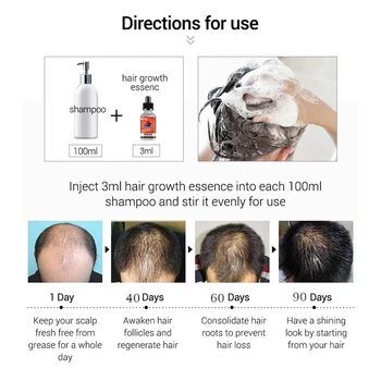 Efektivní Růst Vlasů Sérum Rychlý opětovný Růst Husté na Vlasy, Zabránit vypadávání Vlasů, Poškozené Vlasy Repair Přírodní Produkty pro Péči o Vlasy 30ML