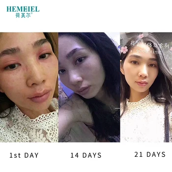 HEMEIEL Péči o Pleť Obličeje Opravy Krém Proti Vráskám Odstranit Zarudnutí Obličeje Hydratační Krém Anti-Aging Obličeje Bělící Krém korejské